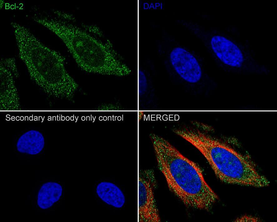 Immunocytochemistry/ Immunofluorescence: Bcl-2 Antibody (PD01-41) [NBP3-32073] - Immunocytochemistry analysis of HeLa cells labeling Bcl-2 with Rabbit anti-Bcl-2 antibody (NBP3-32073) at 1/100 dilution. Cells were fixed in 4% paraformaldehyde for 20 minutes at room temperature, permeabilized with 0.1% Triton X-100 in PBS for 5 minutes at room temperature, then blocked with 1% BSA in 10% negative goat serum for 1 hour at room temperature. Cells were then incubated with Rabbit anti-Bcl-2 antibody (NBP3-32073) at 1/100 dilution in 1% BSA in PBST overnight at 4 ℃. Goat Anti-Rabbit IgG H&L (iFluor™ 488) was used as the secondary antibody at 1/1,000 dilution. PBS instead of the primary antibody was used as the secondary antibody only control. Nuclear DNA was labelled in blue with DAPI. Beta tubulin (red) was stained at 1/100 dilution overnight at +4℃. Goat Anti-Mouse IgG H&L (iFluor™ 594) was used as the secondary antibody at 1/1,000 dilution.