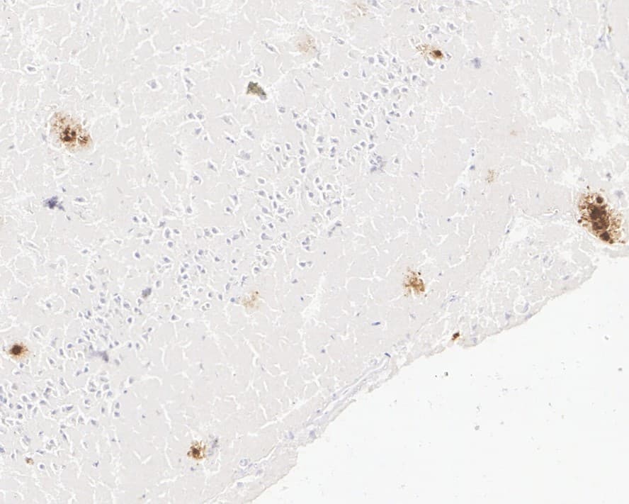 Immunohistochemistry Abeta 40 Antibody (PSH02-82)