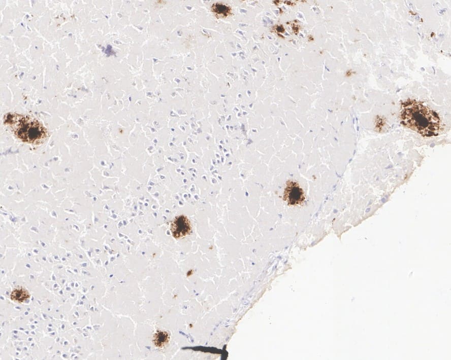 Immunohistochemistry: Abeta 42 Antibody (PSH02-83) [NBP3-32078] - Immunohistochemical analysis of paraffin-embedded mouse model of Alzheimer's brain tissue with Rabbit anti-Abeta 42 antibody (NBP3-32078) at 1/1,000 dilution. The section was pre-treated using heat mediated antigen retrieval with Tris-EDTA buffer (pH 9.0) for 20 minutes. The tissues were blocked in 1% BSA for 20 minutes at room temperature, washed with ddH2O and PBS, and then probed with the primary antibody (NBP3-32078) at 1/1,000 dilution for 1 hour at room temperature. The detection was performed using an HRP conjugated compact polymer system. DAB was used as the chromogen. Tissues were counterstained with hematoxylin and mounted with DPX.