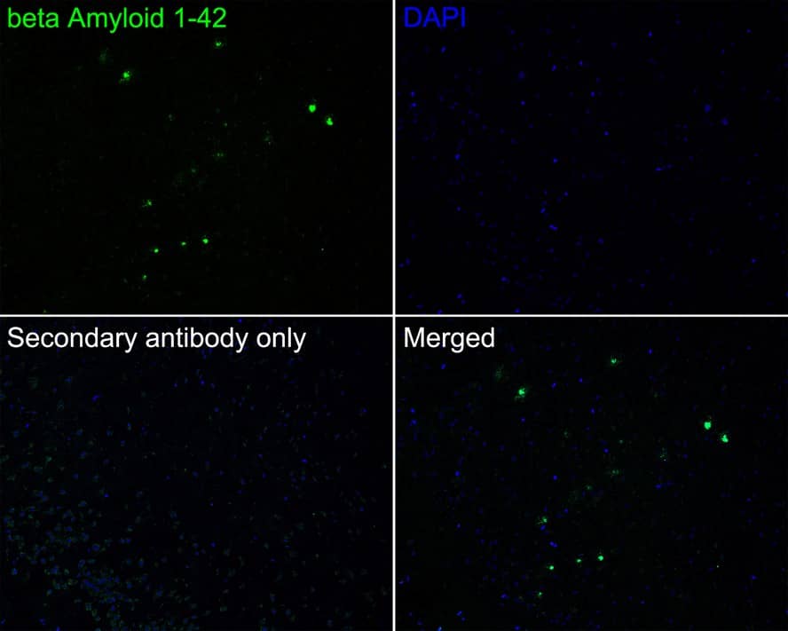 Immunohistochemistry Abeta 42 Antibody (PSH02-83)