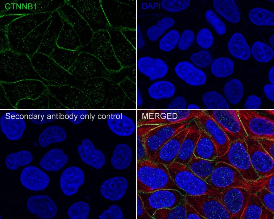 Immunocytochemistry/ Immunofluorescence: beta-Catenin Antibody (A6-F8-R) [NBP3-32079] - Immunocytochemistry analysis of MCF7 cells labeling beta-Catenin with Mouse anti-beta-Catenin antibody (NBP3-32079) at 1/100 dilution. Cells were fixed in 4% paraformaldehyde for 20 minutes at room temperature, permeabilized with 0.1% Triton X-100 in PBS for 5 minutes at room temperature, then blocked with 1% BSA in 10% negative goat serum for 1 hour at room temperature. Cells were then incubated with Mouse anti-beta-Catenin antibody (NBP3-32079) at 1/100 dilution in 1% BSA in PBST overnight at 4 ℃. Goat Anti-Mouse IgG H&L (iFluor™ 488) was used as the secondary antibody at 1/1,000 dilution. PBS instead of the primary antibody was used as the secondary antibody only control. Nuclear DNA was labelled in blue with DAPI. beta Tubulin (red) was stained at 1/100 dilution overnight at +4℃. Goat Anti-Rabbit IgG H&L (iFluor™ 594) were used as the secondary antibody at 1/1,000 dilution.