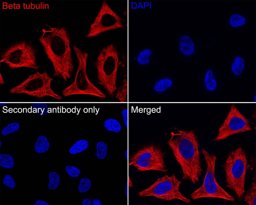 Immunocytochemistry/ Immunofluorescence: beta Tubulin Antibody (A1-A4-R) [NBP3-32081] - Immunocytochemistry analysis of HeLa cells labeling beta Tubulin with Mouse anti-beta Tubulin antibody (NBP3-32081) at 1/100 dilution. Cells were fixed in 4% paraformaldehyde for 20 minutes at room temperature, permeabilized with 0.1% Triton X-100 in PBS for 5 minutes at room temperature, then blocked with 1% BSA in 10% negative goat serum for 1 hour at room temperature. Cells were then incubated with Mouse anti-beta Tubulin antibody (NBP3-32081) at 1/100 dilution in 1% BSA in PBST overnight at 4 ℃. Goat Anti-Mouse IgG H&L (iFluor™ 594) was used as the secondary antibody at 1/1,000 dilution. PBS instead of the primary antibody was used as the secondary antibody only control. Nuclear DNA was labelled in blue with DAPI.