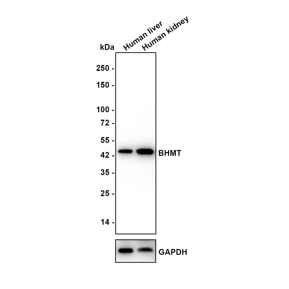 Western blot analysis on different lysates with NBP3-32082 at 1/1,000 dilution. Lane 1: Human liver tissue lysate Lane 2: Human kidney tissue lysate Lysates/proteins at 40 µg/Lane. Predicted band size: 45 kDa Observed band size: 45 kDa Exposure time: 5 seconds; 4-20% SDS-PAGE gel. Proteins were transferred to a PVDF membrane and blocked with 5% NFDM/TBST for 1 hour at room temperature. NBP3-32082 at 1/1,000 dilution was used in 5% NFDM/TBST at 4℃ overnight. Anti-Mouse IgG Secondary Antibody at 1/5,000 dilution was used for 1 hour at room temperature.