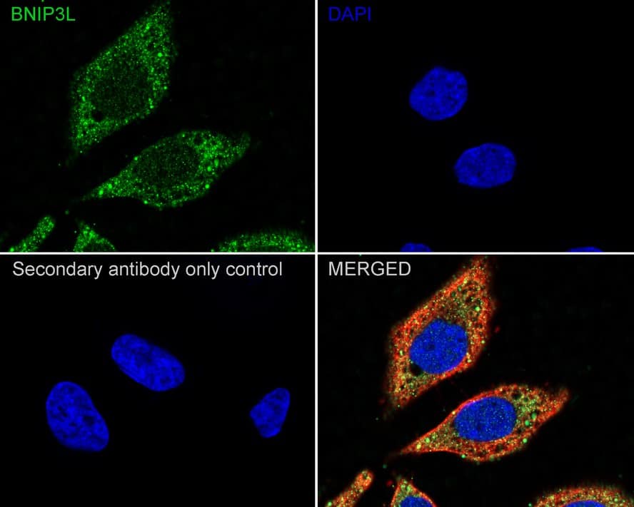 Immunocytochemistry/ Immunofluorescence: BNIP3L Antibody (JE59-98) [NBP3-32087] - Immunocytochemistry analysis of HeLa cells labeling BNIP3L with Rabbit anti-BNIP3L antibody (NBP3-32087) at 1/200 dilution. Cells were fixed in 4% paraformaldehyde for 20 minutes at room temperature, permeabilized with 0.1% Triton X-100 in PBS for 5 minutes at room temperature, then blocked with 1% BSA in 10% negative goat serum for 1 hour at room temperature. Cells were then incubated with Rabbit anti-BNIP3L antibody (NBP3-32087) at 1/200 dilution in 1% BSA in PBST overnight at 4 ℃. Goat Anti-Rabbit IgG H&L (iFluor™ 488) was used as the secondary antibody at 1/1,000 dilution. PBS instead of the primary antibody was used as the secondary antibody only control. Nuclear DNA was labelled in blue with DAPI. Beta tubulin (red) was stained at 1/100 dilution overnight at +4℃. Goat Anti-Mouse IgG H&L (iFluor™ 594) was used as the secondary antibody at 1/1,000 dilution.