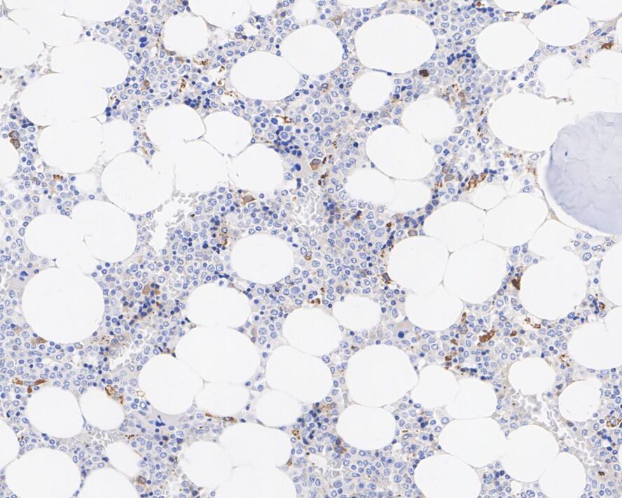 Immunohistochemistry: BNIP3L Antibody (JE59-98) [NBP3-32087] - Immunohistochemical analysis of paraffin-embedded human bone marrow tissue with Rabbit anti-BNIP3L antibody (NBP3-32087) at 1/500 dilution. The section was pre-treated using heat mediated antigen retrieval with Tris-EDTA buffer (pH 9.0) for 20 minutes. The tissues were blocked in 1% BSA for 20 minutes at room temperature, washed with ddH2O and PBS, and then probed with the primary antibody (NBP3-32087) at 1/500 dilution for 1 hour at room temperature. The detection was performed using an HRP conjugated compact polymer system. DAB was used as the chromogen. Tissues were counterstained with hematoxylin and mounted with DPX.