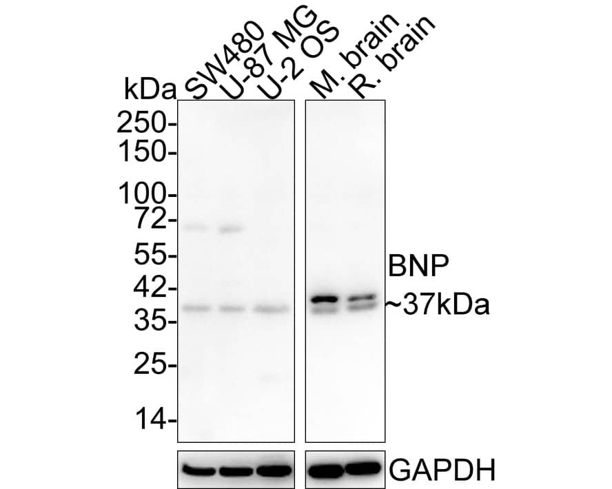 Western blot analysis on different lysates with NBP3-32088 at 1/1,000 dilution. Lane 1: SW480 cell lysate (20 µg/Lane) Lane 2: U-87 MG cell lysate (20 µg/Lane) Lane 3: U-2 OS cell lysate (20 µg/Lane) Lane 4: Mouse brain tissue lysate (30 µg/Lane) Lane 5: Rat brain tissue lysate (30 µg/Lane) Predicted band size: 15 kDa Observed band size: 37 kDa Exposure time: 1 minute; 4-20% SDS-PAGE gel. Proteins were transferred to a PVDF membrane and blocked with 5% NFDM/TBST for 1 hour at room temperature. NBP3-32088 at 1/1,000 dilution was used in 5% NFDM/TBST at 4℃ overnight. Goat Anti-Rabbit IgG [HRP] Secondary Antibody at 1/50,000 dilution was used for 1 hour at room temperature.