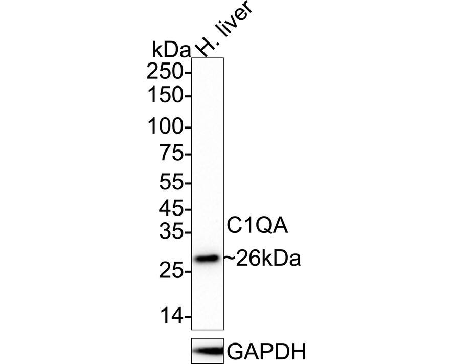 Western blot analysis of  human liver tissue lysates with NBP3-32097 at 1/1,000 dilution. Lysates/proteins at 40 µg/Lane. Predicted band size: 26 kDa Observed band size: 26 kDa Exposure time: 3 minutes;  4-20% SDS-PAGE gel. Proteins were transferred to a PVDF membrane and blocked with 5% NFDM/TBST for 1 hour at room temperature. NBP3-32097 at 1/1,000 dilution was used in 5% NFDM/TBST at 4℃ overnight. Goat Anti-Rabbit IgG [HRP] Secondary Antibody at 1/50,000 dilution was used for 1 hour at room temperature.