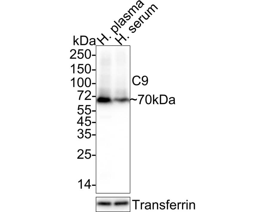Western blot analysis on different lysates with NBP3-32098 at 1/2,000 dilution. Lane 1: Human plasma tissue lysate Lane 2: Human serum tissue lysate Lysates/proteins at 20 µg/Lane. Predicted band size: 63 kDa Observed band size: 70 kDa Exposure time: 10 seconds  4-20% SDS-PAGE gel. Proteins were transferred to a PVDF membrane and blocked with 5% NFDM/TBST for 1 hour at room temperature. NBP3-32098 at 1/2,000 dilution was used in 5% NFDM/TBST at 4℃ overnight. Goat Anti-Rabbit IgG [HRP] Secondary Antibody at 1/50,000 dilution was used for 1 hour at room temperature.