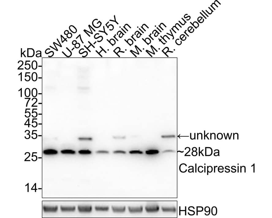 Western Blot: RCAN1 Antibody (JE62-71) [NBP3-32100] - Western blot analysis of RCAN1 on different lysates with Rabbit anti-RCAN1 antibody (NBP3-32100) at 1/1,000 dilution. Lane 1: SW480 cell lysate (20 ug/Lane) Lane 2: U-87 MG cell lysate (20 ug/Lane) Lane 3: SH-SY5Y cell lysate (20 ug/Lane) Lane 4: Human brain tissue lysate (40 ug/Lane) Lane 5: Rat brain tissue lysate (40 ug/Lane) Lane 6: Mouse brain tissue lysate (40 ug/Lane) Lane 7: Mouse thymus tissue lysate (40 ug/Lane) Lane 8: Rat cerebellum tissue lysate (40 ug/Lane) Predicted band size: 28 kDa Observed band size: 28 kDa Exposure time: 24 seconds; 4-20% SDS-PAGE gel. Proteins were transferred to a PVDF membrane and blocked with 5% NFDM/TBST for 1 hour at room temperature. The primary antibody (NBP3-32100) at 1/1,000 dilution was used in 5% NFDM/TBST at 4C  overnight. Goat Anti-Rabbit IgG - HRP Secondary Antibody at 1/50,000 dilution was used for 1 hour at room temperature.