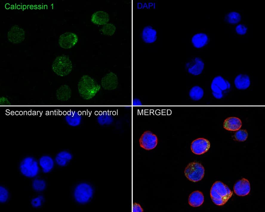 Immunocytochemistry/ Immunofluorescence: RCAN1 Antibody (JE62-71) [NBP3-32100] - Immunocytochemistry analysis of Jurkat cells labeling RCAN1 with Rabbit anti-RCAN1 antibody (NBP3-32100) at 1/100 dilution. Cells were fixed in 4% paraformaldehyde for 20 minutes at room temperature, permeabilized with 0.1% Triton X-100 in PBS for 5 minutes at room temperature, then blocked with 1% BSA in 10% negative goat serum for 1 hour at room temperature. Cells were then incubated with Rabbit anti-RCAN1 antibody (NBP3-32100) at 1/100 dilution in 1% BSA in PBST overnight at 4 ℃. Goat Anti-Rabbit IgG H&L (iFluor™ 488) was used as the secondary antibody at 1/1,000 dilution. PBS instead of the primary antibody was used as the secondary antibody only control. Nuclear DNA was labelled in blue with DAPI. Beta tubulin (red) was stained at 1/100 dilution overnight at +4℃. Goat Anti-Mouse IgG H&L (iFluor™ 594) was used as the secondary antibody at 1/1,000 dilution.