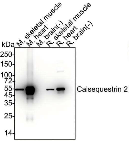Western Blot Calsequestrin 2 Antibody (PSH03-16)