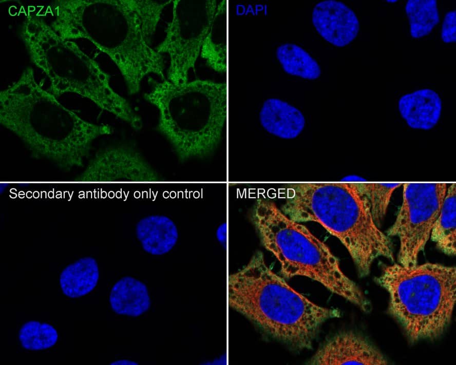 Immunocytochemistry/ Immunofluorescence: CAPZA1 Antibody (A2E7-R) [NBP3-32104] - Immunocytochemistry analysis of HeLa cells labeling CAPZA1 with Mouse anti-CAPZA1 antibody (NBP3-32104) at 1/100 dilution. Cells were fixed in 4% paraformaldehyde for 20 minutes at room temperature, permeabilized with 0.1% Triton X-100 in PBS for 5 minutes at room temperature, then blocked with 1% BSA in 10% negative goat serum for 1 hour at room temperature. Cells were then incubated with Mouse anti-CAPZA1 antibody (NBP3-32104) at 1/100 dilution in 1% BSA in PBST overnight at 4 ℃. Goat Anti-Mouse IgG H&L (iFluor™ 488) was used as the secondary antibody at 1/1,000 dilution. PBS instead of the primary antibody was used as the secondary antibody only control. Nuclear DNA was labelled in blue with DAPI. beta Tubulin (red) was stained at 1/100 dilution overnight at +4℃. Goat Anti-Rabbit IgG H&L (iFluor™ 594) were used as the secondary antibody at 1/1,000 dilution.