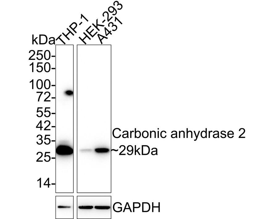 Western blot analysis on different lysates with NBP3-32105 at 1/1,000 dilution. Lane 1: THP-1 cell lysate Lane 2: HEK-293 cell lysate Lane 3: A431 cell lysate Lysates/proteins at 20 µg/Lane. Predicted band size: 29 kDa Observed band size: 29 kDa Exposure time: 40 seconds; 4-20% SDS-PAGE gel. Proteins were transferred to a PVDF membrane and blocked with 5% NFDM/TBST for 1 hour at room temperature. NBP3-32105 at 1/1,000 dilution was used in 5% NFDM/TBST at 4℃ overnight. Goat anti-Mouse IgG [HRP] at 1/50,000 dilution was used for 1 hour at room temperature.