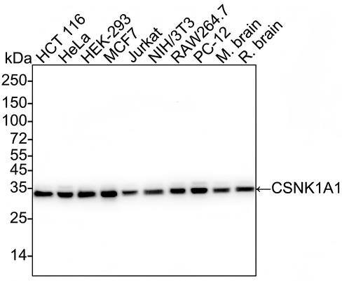 Western blot analysis on different lysates with NBP3-32107 at 1/2,000 dilution and competitor's antibody at 1/2,000 dilution. Lane 1: HCT 116 cell lysate (20 µg/Lane) Lane 2: HeLa cell lysate (20 µg/Lane) Lane 3: HEK-293 cell lysate (20 µg/Lane) Lane 4: MCF7 cell lysate (20 µg/Lane) Lane 5: Jurkat cell lysate (20 µg/Lane) Lane 6: NIH/3T3 cell lysate (20 µg/Lane) Lane 7: RAW264.7 cell lysate (20 µg/Lane) Lane 8: PC-12 cell lysate (20 µg/Lane) Lane 9: Mouse brain tissue lysate (40 µg/Lane) Lane 10: Rat brain tissue lysate (40 µg/Lane) Predicted band size: 39 kDa Observed band size: 34 kDa Exposure time: 15 seconds;  4-20% SDS-PAGE gel. Proteins were transferred to a PVDF membrane and blocked with 5% NFDM/TBST for 1 hour at room temperature. NBP3-32107 at 1/2,000 dilution and competitor's antibody at 1/2,000 dilution were used in 5% NFDM/TBST at 4℃ overnight. Goat Anti-Rabbit IgG [HRP] Secondary Antibody at 1/50,000 dilution was used for 1 hour at room temperature.