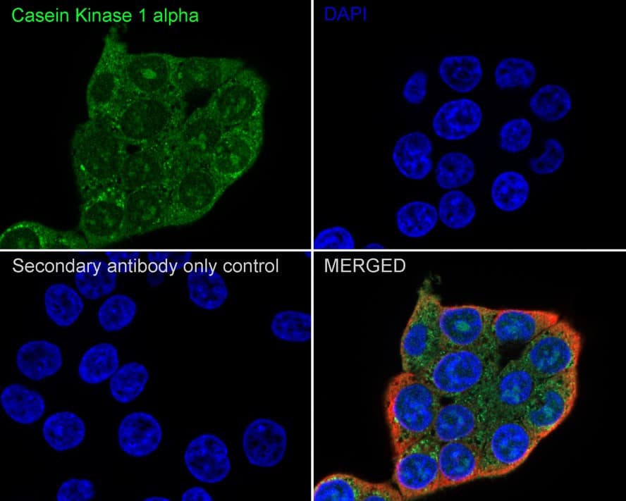 Immunocytochemistry/ Immunofluorescence: Casein Kinase 1 alpha Antibody (PSH04-46) [NBP3-32107] - Immunocytochemistry analysis of HCT 116 cells labeling Casein Kinase 1 alpha with Rabbit anti-Casein Kinase 1 alpha antibody (NBP3-32107) at 1/500 dilution. Cells were fixed in 4% paraformaldehyde for 20 minutes at room temperature, permeabilized with 0.1% Triton X-100 in PBS for 5 minutes at room temperature, then blocked with 1% BSA in 10% negative goat serum for 1 hour at room temperature. Cells were then incubated with Rabbit anti-Casein Kinase 1 alpha antibody (NBP3-32107) at 1/500 dilution in 1% BSA in PBST overnight at 4 ℃. Goat Anti-Rabbit IgG H&L (iFluor™ 488) was used as the secondary antibody at 1/1,000 dilution. PBS instead of the primary antibody was used as the secondary antibody only control. Nuclear DNA was labelled in blue with DAPI. Beta tubulin (red) was stained at 1/100 dilution overnight at +4℃. Goat Anti-Mouse IgG H&L (iFluor™ 594) was used as the secondary antibody at 1/1,000 dilution.