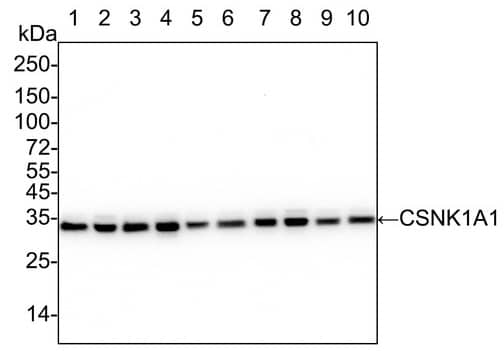 Western Blot: Casein Kinase 1 alpha Antibody (PSH04-46) [NBP3-32107] - Western blot analysis of Casein Kinase 1 alpha on different lysates with Rabbit anti-Casein Kinase 1 alpha antibody (NBP3-32107) at 1/2,000 dilution.Lane 1: HCT 116 cell lysate (20 µg/Lane)Lane 2: HeLa cell lysate (20 µg/Lane)Lane 3: HEK-293 cell lysate (20 µg/Lane)Lane 4: MCF7 cell lysate (20 µg/Lane)Lane 5: Jurkat cell lysate (20 µg/Lane)Lane 6: NIH/3T3 cell lysate (20 µg/Lane)Lane 7: RAW264.7 cell lysate (20 µg/Lane)Lane 8: PC-12 cell lysate (20 µg/Lane)Lane 9: Mouse brain tissue lysate (40 µg/Lane)Lane 10: Rat brain tissue lysate (40 µg/Lane)Predicted band size: 39 kDaObserved band size: 34 kDaExposure time: 15 seconds; ECL;4-20% SDS-PAGE gel.Proteins were transferred to a PVDF membrane and blocked with 5% NFDM/TBST for 1 hour at room temperature. The primary antibody at 1/2,000 dilution was used in 5% NFDM/TBST at 4℃ overnight. Goat Anti-Rabbit IgG - HRP Secondary Antibody at 1/50,000 dilution was used for 1 hour at room temperature.