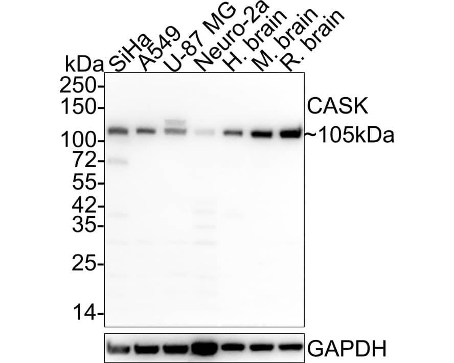 Western Blot: CASK Antibody (A1C5-R) [NBP3-32108] - Western blot analysis of CASK on different lysates with Mouse anti-CASK antibody (NBP3-32108) at 1/2,000 dilution. Lane 1: SiHa cell lysate Lane 2: A549 cell lysate Lane 3: U-87 MG cell lysate Lane 4: Neuro-2a cell lysate Lane 5: Human brain tissue lysate Lane 6: Mouse brain tissue lysate Lane 7: Rat brain tissue lysate Lysates/proteins at 30 ug/Lane. Predicted band size: 105 kDa Observed band size: 105 kDa Exposure time: 1 minute; 4-20% SDS-PAGE gel. Proteins were transferred to a PVDF membrane and blocked with 5% NFDM/TBST for 1 hour at room temperature. The primary antibody (NBP3-32108) at 1/2,000 dilution was used in 5% NFDM/TBST at 4C overnight. Goat Anti-Mouse IgG - HRP Secondary Antibody at 1/50,000 dilution was used for 1 hour at room temperature.