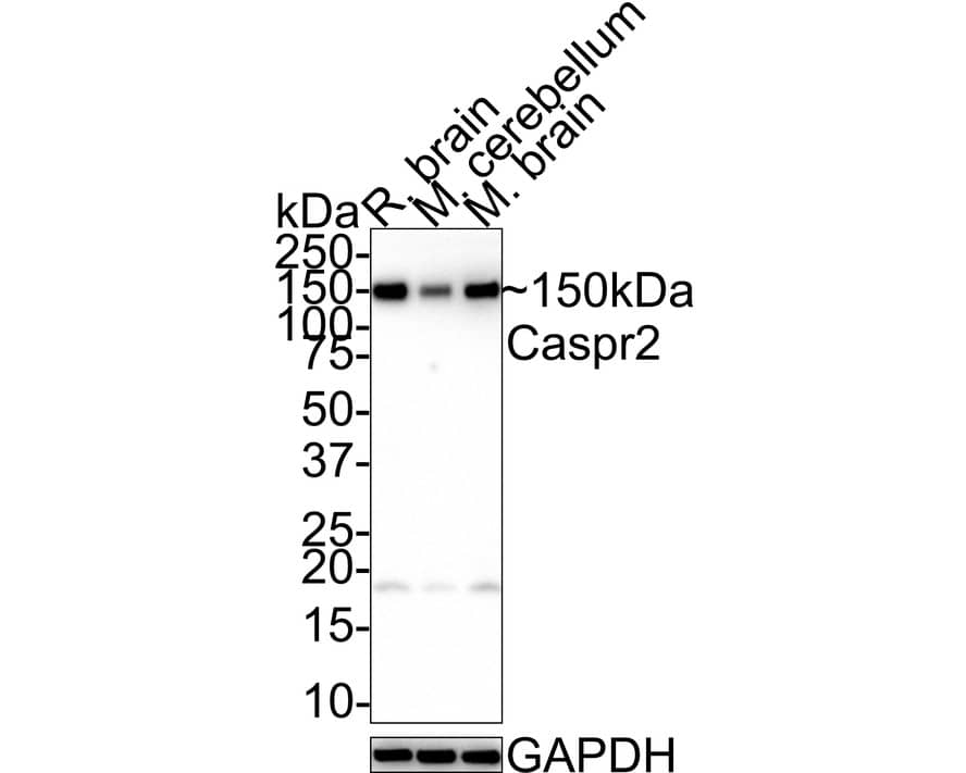 Western blot analysis on different lysates with NBP3-32110 at 1/1,000 dilution. Lane 1: Rat brain tissue lysate Lane 2: Mouse cerebellum tissue lysate Lane 3: Mouse brain tissue lysate Lysates/proteins at 40 µg/Lane. Predicted band size: 148 kDa Observed band size: 150 kDa Exposure time: 2 minutes; 4-20% SDS-PAGE gel. Proteins were transferred to a PVDF membrane and blocked with 5% NFDM/TBST for 1 hour at room temperature. NBP3-32110 at 1/1,000 dilution was used in 5% NFDM/TBST at room temperature for 2 hours. Goat Anti-Rabbit IgG [HRP] Secondary Antibody at 1:100,000 dilution was used for 1 hour at room temperature.