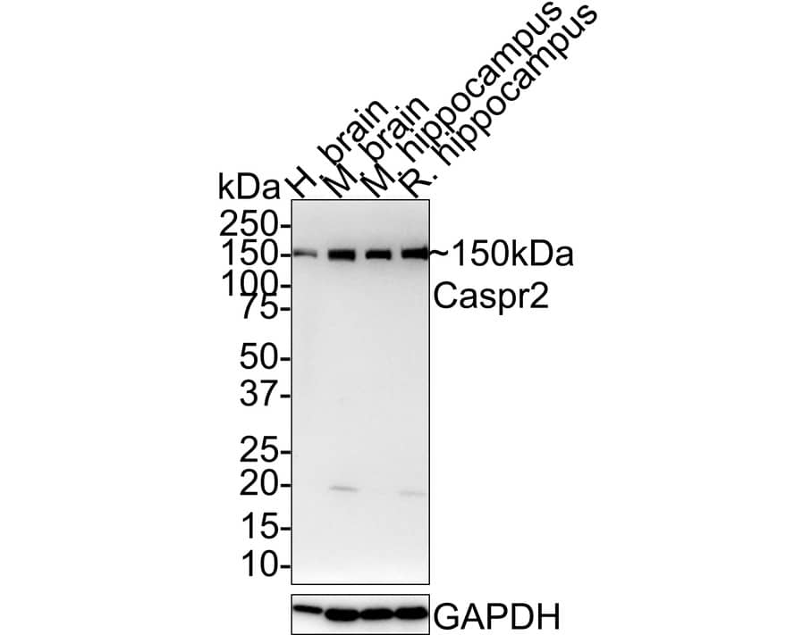 Western Blot: Caspr2 Antibody (JE41-03) [NBP3-32110] - Western blot analysis of Caspr2 on different lysates with Rabbit anti-Caspr2 antibody (NBP3-32110) at 1/1,000 dilution. Lane 1: Human brain tissue lysate Lane 2: Mouse brain tissue lysate Lane 3: Mouse hippocampus tissue lysate Lane 4: Rat hippocampus tissue lysate Lysates/proteins at 40 ug/Lane. Predicted band size: 148 kDa Observed band size: 150 kDa Exposure time: 5 minutes; 4-20% SDS-PAGE gel. Proteins were transferred to a PVDF membrane and blocked with 5% NFDM/TBST for 1 hour at room temperature. The primary antibody (NBP3-32110) at 1/1,000 dilution was used in 5% NFDM/TBST at 4C overnight. Goat Anti-Rabbit IgG - HRP Secondary Antibody at 1:100,000 dilution was used for 1 hour at room temperature.