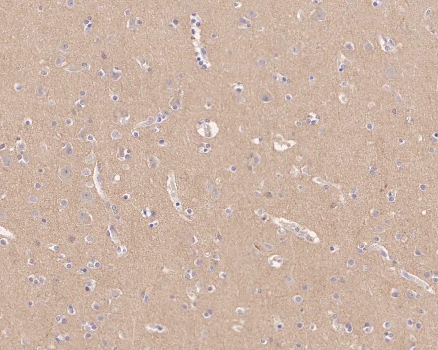 Immunohistochemistry: Caspr2 Antibody (JE41-03) [NBP3-32110] - Immunohistochemical analysis of paraffin-embedded human brain tissue with Rabbit anti-Caspr2 antibody (NBP3-32110) at 1/200 dilution. The section was pre-treated using heat mediated antigen retrieval with Tris-EDTA buffer (pH 9.0) for 20 minutes. The tissues were blocked in 1% BSA for 20 minutes at room temperature, washed with ddH2O and PBS, and then probed with the primary antibody (NBP3-32110) at 1/200 dilution for 1 hour at room temperature. The detection was performed using an HRP conjugated compact polymer system. DAB was used as the chromogen. Tissues were counterstained with hematoxylin and mounted with DPX.