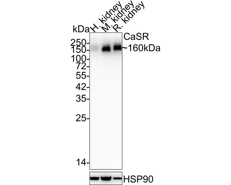 Western blot analysis on different lysates with NBP3-32111 at 1/2,000 dilution. Lane 1: Human kidney tissue lysate (40 µg/Lane) Lane 2: Mouse kidney tissue lysate (no heat) (40 µg/Lane) Lane 3: Rat kidney tissue lysate (no heat) (40 µg/Lane) Notice: no heat means the lysate is not boiled. Predicted band size: 121 kDa Observed band size: 160 kDa Exposure time: 1 minute 50 seconds;  4-20% SDS-PAGE gel. Proteins were transferred to a PVDF membrane and blocked with 5% NFDM/TBST for 1 hour at room temperature. NBP3-32111 at 1/2,000 dilution was used in 5% NFDM/TBST at 4℃ overnight. Goat Anti-Rabbit IgG [HRP] Secondary Antibody at 1/50,000 dilution was used for 1 hour at room temperature.
