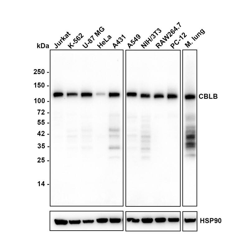 Western Blot CBLB Antibody (PSH03-49)