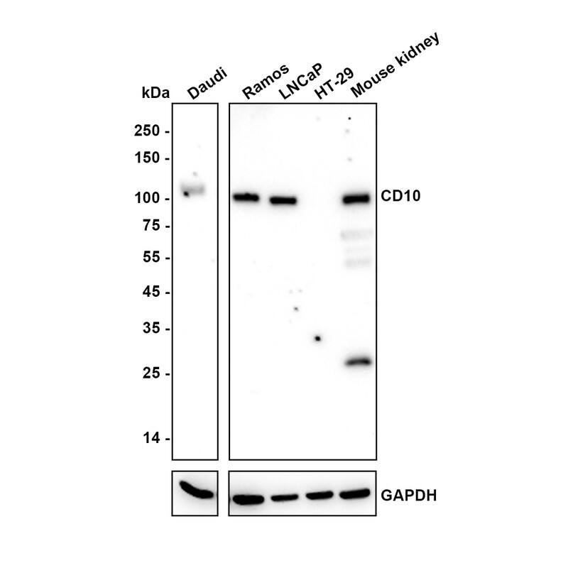 Western blot analysis on different lysates with NBP3-32118 at 1/2,000 dilution. Lane 1: Daudi cell lysate (20 µg/Lane) Lane 2: Ramos cell lysate (20 µg/Lane) Lane 3: LNCaP cell lysate (20 µg/Lane) Lane 4: HT-29 cell lysate (negative) (20 µg/Lane) Lane 5: Mouse kidney tissue lysate (40 µg/Lane) Predicted band size: 86 kDa Observed band size: 100 kDa Exposure time: 5 minutes; 4-20% SDS-PAGE gel. Proteins were transferred to a PVDF membrane and blocked with 5% NFDM/TBST for 1 hour at room temperature. NBP3-32118 at 1/2,000 dilution was used in 5% NFDM/TBST at 4℃ overnight. Goat anti-Mouse IgG [HRP] at 1/50,000 dilution was used for 1 hour at room temperature.