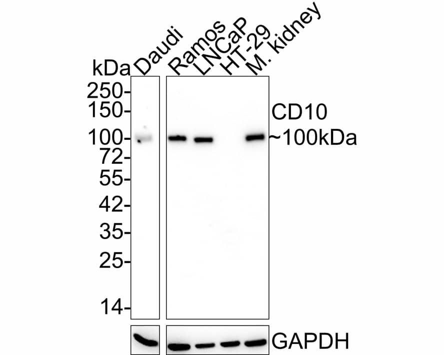 Western Blot: Neprilysin/CD10 Antibody (A1G3-R) [NBP3-32118] - Western blot analysis of Neprilysin/CD10 on different lysates with Mouse anti-Neprilysin/CD10 antibody (NBP3-32118) at 1/2,000 dilution. Lane 1: Daudi cell lysate (20 ug/Lane) Lane 2: Ramos cell lysate (20 ug/Lane) Lane 3: LNCaP cell lysate (20 ug/Lane) Lane 4: HT-29 cell lysate (20 ug/Lane) (negative) Lane 5: Mouse kidney tissue lysate (40 ug/Lane) Predicted band size: 86 kDa Observed band size: 100 kDa Exposure time: 5 minutes; 4-20% SDS-PAGE gel. Proteins were transferred to a PVDF membrane and blocked with 5% NFDM/TBST for 1 hour at room temperature. The primary antibody (NBP3-32118) at 1/2,000 dilution was used in 5% NFDM/TBST at 4C overnight. Goat Anti-Mouse IgG - HRP Secondary Antibody at 1/50,000 dilution was used for 1 hour at room temperature.