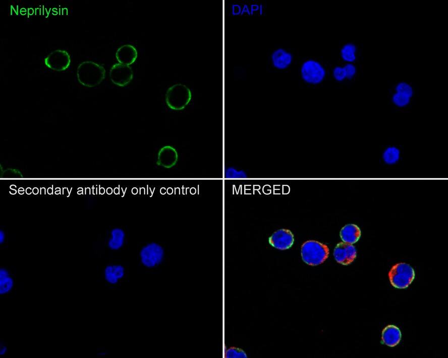 Immunocytochemistry/ Immunofluorescence: Neprilysin/CD10 Antibody (A1G3-R) [NBP3-32118] - Immunocytochemistry analysis of Raji cells labeling Neprilysin/CD10 with Mouse anti-Neprilysin/CD10 antibody (NBP3-32118) at 1/100 dilution. Cells were fixed in 100% precooled methanol for 5 minutes at room temperature, then blocked with 1% BSA in 10% negative goat serum for 1 hour at room temperature. Cells were then incubated with Mouse anti-Neprilysin/CD10 antibody (NBP3-32118) at 1/100 dilution in 1% BSA in PBST overnight at 4 ℃. Goat Anti-Mouse IgG H&L (iFluor™ 488) was used as the secondary antibody at 1/1,000 dilution. PBS instead of the primary antibody was used as the secondary antibody only control. Nuclear DNA was labelled in blue with DAPI. beta Tubulin (red) was stained at 1/100 dilution overnight at +4℃. Goat Anti-Rabbit IgG H&L (iFluor™ 594) were used as the secondary antibody at 1/1,000 dilution.