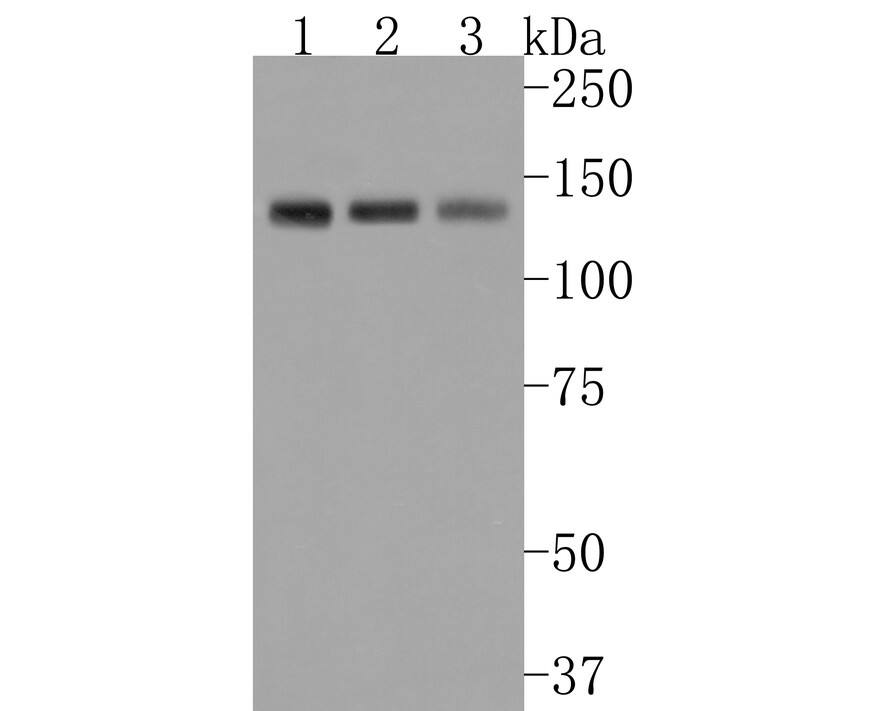 Western blot analysis on different lysates with NBP3-32119 at 1/500 dilution. Lane 1: Jurkat cell lysate Lane 2: Daudi cell lysate Lane 3: HL-60 cell lysate Lysates/proteins at 10 µg/Lane. Predicted band size: 96 kDa Observed band size: 130 kDa Exposure time: 30 seconds; 8% SDS-PAGE gel. Proteins were transferred to a PVDF membrane and blocked with 5% NFDM/TBST for 1 hour at room temperature. NBP3-32119 at 1/500 dilution was used in 5% NFDM/TBST at room temperature for 2 hours. Goat Anti-Rabbit IgG [HRP] Secondary Antibody at 1:200,000 dilution was used for 1 hour at room temperature.