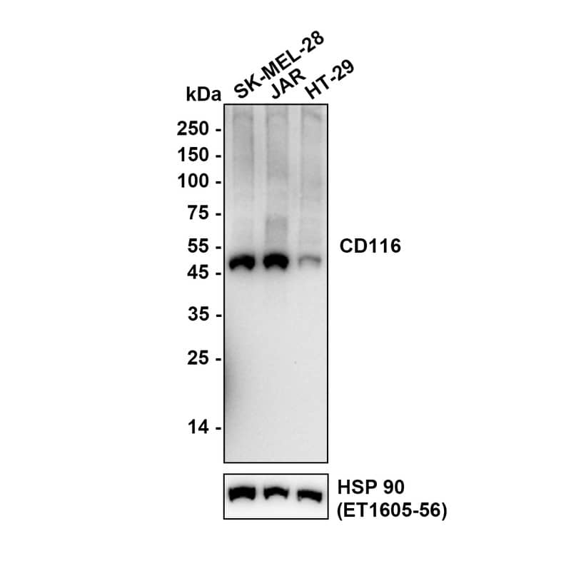 Western blot analysis on different lysates with NBP3-32120 at 1/5,000 dilution. Lane 1: SK-MEL-28 (Human malignant melanoma cell) cell lysate Lane 2: JAR (Human placental choriocarcinoma cell) cell lysate Lane 3: HT-29 (Human colorectal adenocarcinoma cell) cell lysate Lysates/proteins at 15 µg/Lane. Exposure time: 180 seconds Low expression: HT-29(PMID: 28811578) Blocking: 5% NFDM/TBST, 1 hour at room temperature Primary antibody: NBP3-32120, 1/5,000 in primary antibody dilution buffer, overnight at 4 ℃ Secondary antibody: Goat Anti-Rabbit IgG [HRP] Secondary Antibody, 1/50,000 in 5% NFDM/TBST, 1 hour at room temperature Predicted band size: 46 kDa Observed band size: 50 kDa