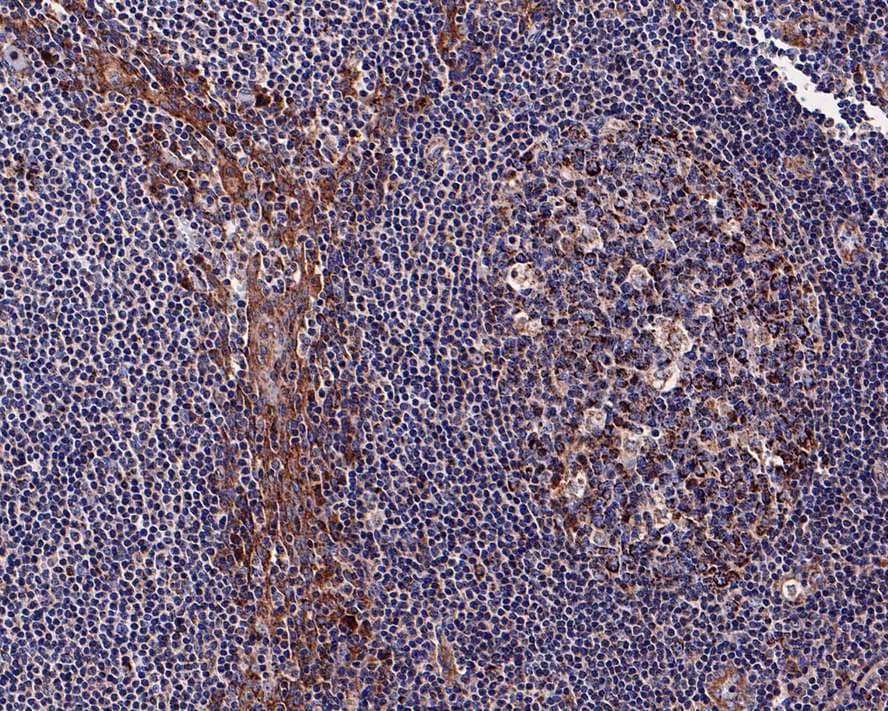 Immunohistochemistry: IL-7R alpha/CD127 Antibody (JE37-10) [NBP3-32122] - Immunohistochemical analysis of paraffin-embedded human tonsil tissue with Rabbit anti-IL-7R alpha/CD127 antibody (NBP3-32122) at 1/200 dilution. The section was pre-treated using heat mediated antigen retrieval with Tris-EDTA buffer (pH 9.0) for 20 minutes. The tissues were blocked in 1% BSA for 20 minutes at room temperature, washed with ddH2O and PBS, and then probed with the primary antibody (NBP3-32122) at 1/200 dilution for 1 hour at room temperature. The detection was performed using an HRP conjugated compact polymer system. DAB was used as the chromogen. Tissues were counterstained with hematoxylin and mounted with DPX.