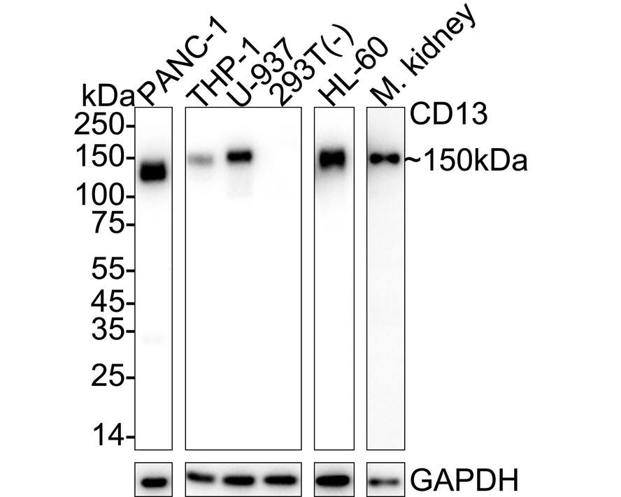 Western blot analysis on different lysates with NBP3-32123 at 1/2,000 dilution. Lane 1: PANC-1 cell lysate (5 µg/Lane) Lane 2: THP-1 cell lysate (30 µg/Lane) Lane 3: U-937 cell lysate (20 µg/Lane) Lane 4: 293T cell lysate (negative) (20 µg/Lane) Lane 5: HL-60 cell lysate (20 µg/Lane) Lane 6: Mouse kidney tissue lysate (20 µg/Lane) Predicted band size: 110 kDa Observed band size: 150 kDa Exposure time: Lane 1: 9 seconds; Lane 2-5: 24 seconds; Lane 6: 1 minute 45 seconds;  4-20% SDS-PAGE gel. Proteins were transferred to a PVDF membrane and blocked with 5% NFDM/TBST for 1 hour at room temperature. NBP3-32123 at 1/2,000 dilution was used in 5% NFDM/TBST at 4℃ overnight. Goat Anti-Rabbit IgG [HRP] Secondary Antibody at 1/50,000 dilution was used for 1 hour at room temperature.