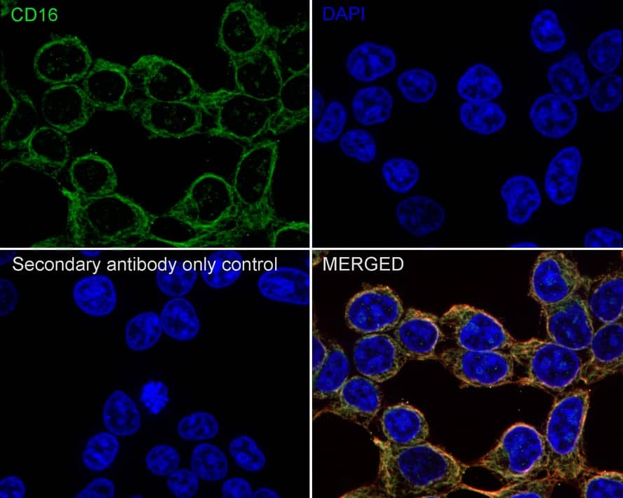 Immunocytochemistry/ Immunofluorescence: Fc gamma RIII (CD16) Antibody (PD00-12) [NBP3-32127] - Immunocytochemistry analysis of 293T cells labeling Fc gamma RIII (CD16) with Rabbit anti-Fc gamma RIII (CD16) antibody (NBP3-32127) at 1/100 dilution. Cells were fixed in 100% precooled methanol for 5 minutes at room temperature, then blocked with 1% BSA in 10% negative goat serum for 1 hour at room temperature. Cells were then incubated with Rabbit anti-Fc gamma RIII (CD16) antibody (NBP3-32127) at 1/100 dilution in 1% BSA in PBST overnight at 4 ℃. Goat Anti-Rabbit IgG H&L (iFluor™ 488) was used as the secondary antibody at 1/1,000 dilution. PBS instead of the primary antibody was used as the secondary antibody only control. Nuclear DNA was labelled in blue with DAPI. Beta tubulin (red) was stained at 1/100 dilution overnight at +4℃. Goat Anti-Mouse IgG H&L (iFluor™ 594) was used as the secondary antibody at 1/1,000 dilution.