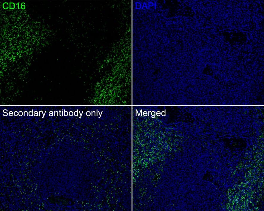 Immunohistochemistry: Fc gamma RIII (CD16) Antibody (PD00-12) [NBP3-32127] - Immunofluorescence analysis of paraffin-embedded human spleen tissue labeling Fc gamma RIII (CD16) with Rabbit anti-Fc gamma RIII (CD16) antibody (NBP3-32127) at 1/200 dilution. The section was pre-treated using heat mediated antigen retrieval with Tris-EDTA buffer (pH 9.0) for 20 minutes. The tissues were blocked in 10% negative goat serum for 1 hour at room temperature, washed with PBS, and then probed with the primary antibody (NBP3-32127, green) at 1/200 dilution overnight at 4 ℃, washed with PBS. Goat Anti-Rabbit IgG H&L (iFluor™ 488) was used as the secondary antibody at 1/1,000 dilution. Nuclei were counterstained with DAPI (blue).