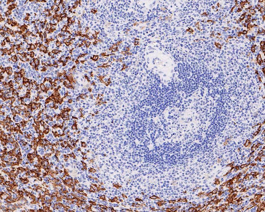 Immunohistochemistry: Fc gamma RIII (CD16) Antibody (PD00-12) [NBP3-32127] - Immunohistochemical analysis of paraffin-embedded human spleen tissue with Rabbit anti-Fc gamma RIII (CD16) antibody (NBP3-32127) at 1/1,000 dilution. The section was pre-treated using heat mediated antigen retrieval with Tris-EDTA buffer (pH 9.0) for 20 minutes. The tissues were blocked in 1% BSA for 20 minutes at room temperature, washed with ddH2O and PBS, and then probed with the primary antibody (NBP3-32127) at 1/1,000 dilution for 1 hour at room temperature. The detection was performed using an HRP conjugated compact polymer system. DAB was used as the chromogen. Tissues were counterstained with hematoxylin and mounted with DPX.