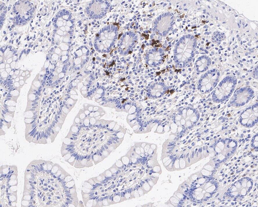 Immunohistochemistry: CD163L1 Antibody (JE54-30) [NBP3-32128] - Immunohistochemical analysis of paraffin-embedded human small intestine tissue with Rabbit anti-CD163L1 antibody (NBP3-32128) at 1/1,000 dilution. The section was pre-treated using heat mediated antigen retrieval with Tris-EDTA buffer (pH 9.0) for 20 minutes. The tissues were blocked in 1% BSA for 20 minutes at room temperature, washed with ddH2O and PBS, and then probed with the primary antibody (NBP3-32128) at 1/1,000 dilution for 1 hour at room temperature. The detection was performed using an HRP conjugated compact polymer system. DAB was used as the chromogen. Tissues were counterstained with hematoxylin and mounted with DPX.