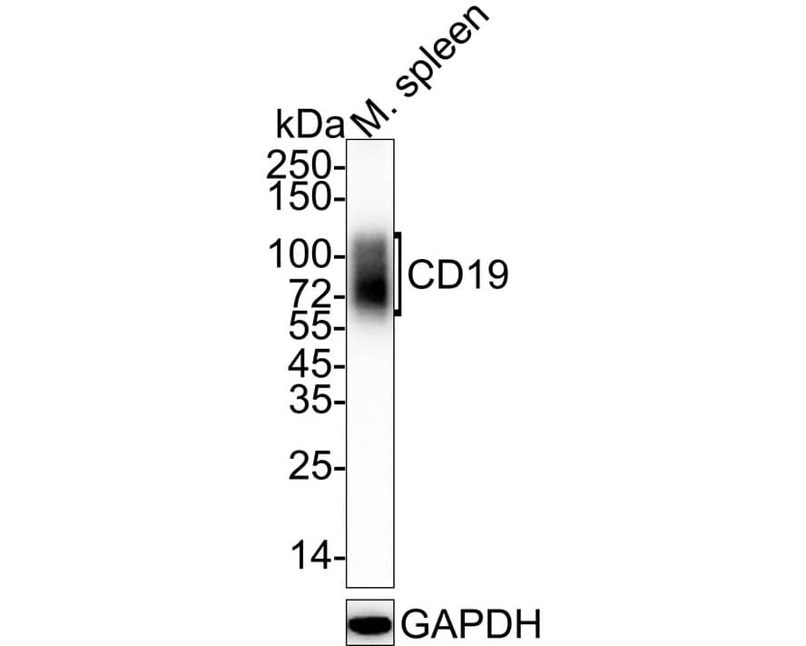 Western blot analysis of  mouse spleen tissue lysates with NBP3-32130 at 1/1,000 dilution. Lysates/proteins at 20 µg/Lane. Predicted band size: 60 kDa Observed band size: 60-120 kDa Exposure time: 30 seconds; 4-20% SDS-PAGE gel. Proteins were transferred to a PVDF membrane and blocked with 5% NFDM/TBST for 1 hour at room temperature. NBP3-32130 at 1/1,000 dilution was used in 5% NFDM/TBST at 4℃ overnight. Goat Anti-Rabbit IgG [HRP] Secondary Antibody at 1/50,000 dilution was used for 1 hour at room temperature.