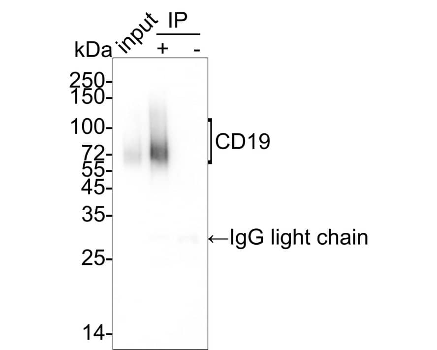 Immunoprecipitation: CD19 Antibody (PSH03-94) [NBP3-32130] - CD19 was immunoprecipitated in 0.2mg Mouse spleen tissue lysate with NBP3-32130 at 2 ug/25 ul agarose. Western blot was performed from the immunoprecipitate using NBP3-32130 at 1/1,000 dilution. Anti-Rabbit IgG for IP Nano-secondary antibody at 1/5,000 dilution was used for 1 hour at room temperature. Lane 1: Mouse spleen tissue lysate (input) Lane 2: NBP3-32130 IP in Mouse spleen tissue lysate Lane 3: Rabbit IgG instead of NBP3-32130 in Mouse spleen tissue lysate Blocking/Dilution buffer: 5% NFDM/TBST Exposure time: 17 seconds