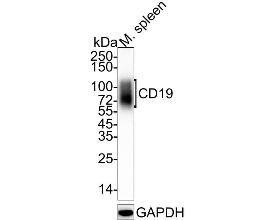 Western Blot: CD19 Antibody (PSH03-94) [NBP3-32130] - Western blot analysis of CD19 on mouse spleen tissue lysates with Rabbit anti-CD19 antibody (NBP3-32130) at 1/1,000 dilution. Lysates/proteins at 20 ug/Lane. Predicted band size: 60 kDa Observed band size: 60-120 kDa Exposure time: 30 seconds; 4-20% SDS-PAGE gel. Proteins were transferred to a PVDF membrane and blocked with 5% NFDM/TBST for 1 hour at room temperature. The primary antibody (NBP3-32130) at 1/1,000 dilution was used in 5% NFDM/TBST at 4C overnight. Goat Anti-Rabbit IgG - HRP Secondary Antibody at 1/50,000 dilution was used for 1 hour at room temperature.