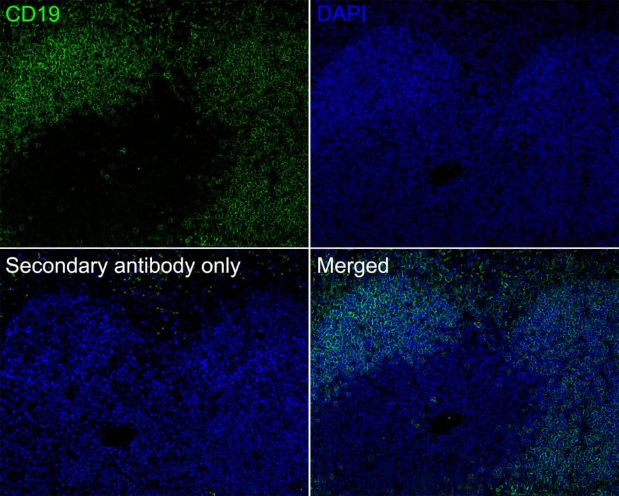 Immunohistochemistry: CD19 Antibody (PSH03-94) [NBP3-32130] - Immunofluorescence analysis of paraffin-embedded mouse spleen tissue labeling CD19 with Rabbit anti-CD19 antibody (NBP3-32130) at 1/200 dilution. The section was pre-treated using heat mediated antigen retrieval with Tris-EDTA buffer (pH 9.0) for 20 minutes. The tissues were blocked in 10% negative goat serum for 1 hour at room temperature, washed with PBS, and then probed with the primary antibody (NBP3-32130, green) at 1/200 dilution overnight at 4 ℃, washed with PBS. Goat Anti-Rabbit IgG H&L (iFluor™ 488) was used as the secondary antibody at 1/1,000 dilution. Nuclei were counterstained with DAPI (blue).