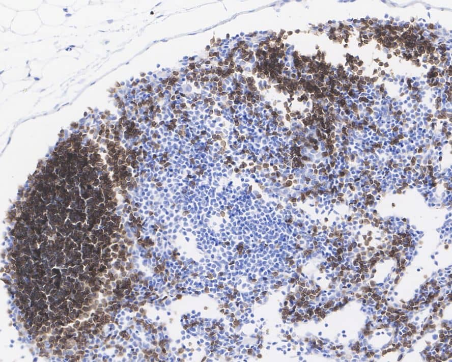 Immunohistochemistry: CD19 Antibody (PSH03-94) [NBP3-32130] - Immunohistochemical analysis of paraffin-embedded mouse lymph node tissue with Rabbit anti-CD19 antibody (NBP3-32130) at 1/500 dilution. The section was pre-treated using heat mediated antigen retrieval with Tris-EDTA buffer (pH 9.0) for 20 minutes. The tissues were blocked in 1% BSA for 20 minutes at room temperature, washed with ddH2O and PBS, and then probed with the primary antibody (NBP3-32130) at 1/500 dilution for 1 hour at room temperature. The detection was performed using an HRP conjugated compact polymer system. DAB was used as the chromogen. Tissues were counterstained with hematoxylin and mounted with DPX.