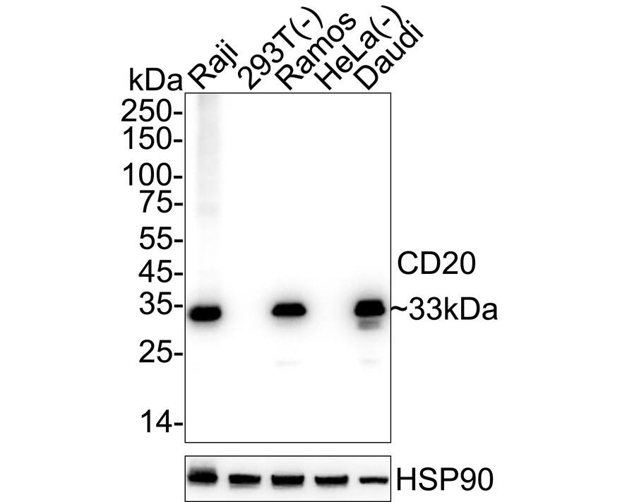 Western blot analysis on different lysates with NBP3-32131 at 1/2,000 dilution. Lane 1: Raji cell lysate Lane 2: 293T cell lysate (negative) Lane 3: Ramos cell lysate Lane 4: HeLa cell lysate (negative) Lane 5: Daudi cell lysate Lysates/proteins at 20 µg/Lane. Predicted band size: 33 kDa Observed band size: 33 kDa Exposure time: 4 seconds;  4-20% SDS-PAGE gel. Proteins were transferred to a PVDF membrane and blocked with 5% NFDM/TBST for 1 hour at room temperature. NBP3-32131 at 1/2,000 dilution was used in 5% NFDM/TBST at 4℃ overnight. Goat Anti-Rabbit IgG [HRP] Secondary Antibody at 1/50,000 dilution was used for 1 hour at room temperature.