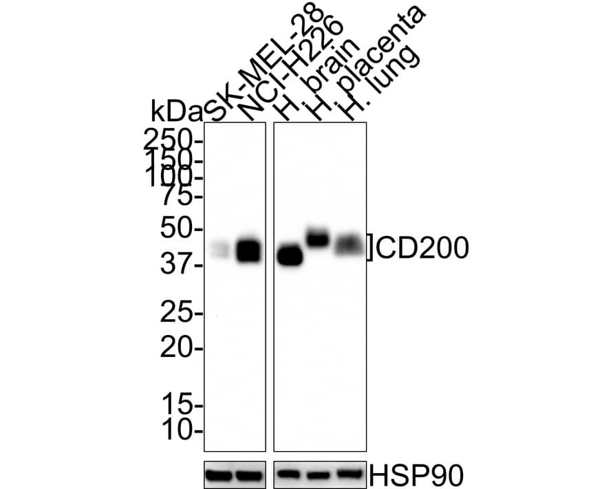 Western Blot: CD200/OX2 Antibody (PSH01-48) [NBP3-32132] - Western blot analysis of CD200/OX2 on different lysates with Rabbit anti-CD200/OX2 antibody (NBP3-32132) at 1/1,000 dilution. Lane 1: SK-MEL-28 cell lysate (20 ug/Lane) Lane 2: NCI-H226 cell lysate (20 ug/Lane) Lane 3: Human brain tissue lysate (30 ug/Lane) Lane 4: Human placenta tissue lysate (30 ug/Lane) Lane 5: Human lung tissue lysate (30 ug/Lane) Predicted band size: 31 kDa Observed band size: 40-50kDa Exposure time: 40 seconds; 4-20% SDS-PAGE gel. Proteins were transferred to a PVDF membrane and blocked with 5% NFDM/TBST for 1 hour at room temperature. The primary antibody (NBP3-32132) at 1/1,000 dilution was used in 5% NFDM/TBST at room temperature for 2 hours. Goat Anti-Rabbit IgG - HRP Secondary Antibody at 1/100,000 dilution was used for 1 hour at room temperature.