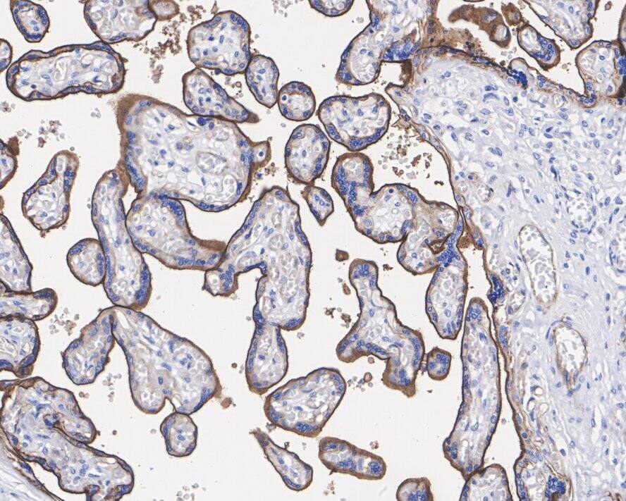 Immunohistochemistry: CD200/OX2 Antibody (PSH01-48) [NBP3-32132] - Immunohistochemical analysis of paraffin-embedded human placenta tissue with Rabbit anti-CD200/OX2 antibody (NBP3-32132) at 1/2,000 dilution. The section was pre-treated using heat mediated antigen retrieval with Tris-EDTA buffer (pH 9.0) for 20 minutes. The tissues were blocked in 1% BSA for 20 minutes at room temperature, washed with ddH2O and PBS, and then probed with the primary antibody (NBP3-32132) at 1/2,000 dilution for 1 hour at room temperature. The detection was performed using an HRP conjugated compact polymer system. DAB was used as the chromogen. Tissues were counterstained with hematoxylin and mounted with DPX.