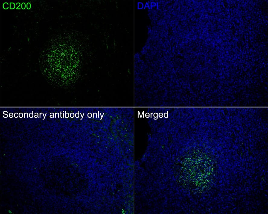Immunohistochemistry: CD200/OX2 Antibody (PSH01-48) [NBP3-32132] - Immunofluorescence analysis of paraffin-embedded human tonsil tissue labeling CD200/OX2 with Rabbit anti-CD200/OX2 antibody (NBP3-32132) at 1/200 dilution. The section was pre-treated using heat mediated antigen retrieval with Tris-EDTA buffer (pH 9.0) for 20 minutes. The tissues were blocked in 10% negative goat serum for 1 hour at room temperature, washed with PBS, and then probed with the primary antibody (NBP3-32132, green) at 1/200 dilution overnight at 4 ℃, washed with PBS. Goat Anti-Rabbit IgG H&L (iFluor™ 488) was used as the secondary antibody at 1/1,000 dilution. Nuclei were counterstained with DAPI (blue).
