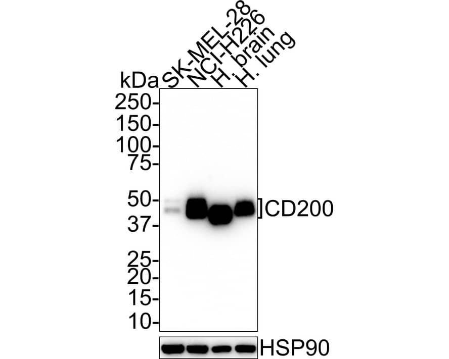 Western Blot: CD200/OX2 Antibody (PSH01-49) [NBP3-32133] - Western blot analysis of CD200/OX2 on different lysates with Rabbit anti-CD200/OX2 antibody (NBP3-32133) at 1/1,000 dilution. Lane 1: SK-MEL-28 cell lysate Lane 2: NCI-H226 cell lysate Lane 3: Human brain tissue lysate Lane 4: Human lung tissue lysate Lysates/proteins at 20 ug/Lane. Predicted band size: 31 kDa Observed band size: 40-50kDa Exposure time: 2 minutes 10 seconds; 4-20% SDS-PAGE gel. Proteins were transferred to a PVDF membrane and blocked with 5% NFDM/TBST for 1 hour at room temperature. The primary antibody (NBP3-32133) at 1/1,000 dilution was used in 5% NFDM/TBST at room temperature for 2 hours. Goat Anti-Rabbit IgG - HRP Secondary Antibody at 1/100,000 dilution was used for 1 hour at room temperature.