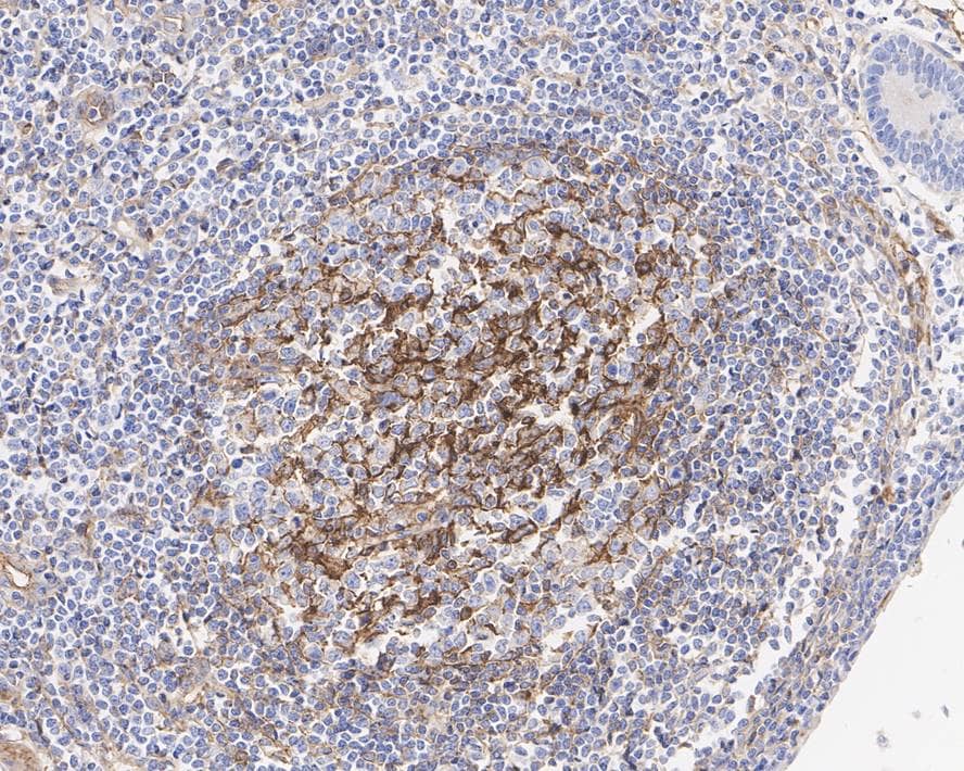 Immunohistochemistry: CD200/OX2 Antibody (PSH01-49) [NBP3-32133] - Immunohistochemical analysis of paraffin-embedded human lymph node tissue with Rabbit anti-CD200/OX2 antibody (NBP3-32133) at 1/2,000 dilution. The section was pre-treated using heat mediated antigen retrieval with Tris-EDTA buffer (pH 9.0) for 20 minutes. The tissues were blocked in 1% BSA for 20 minutes at room temperature, washed with ddH2O and PBS, and then probed with the primary antibody (NBP3-32133) at 1/2,000 dilution for 1 hour at room temperature. The detection was performed using an HRP conjugated compact polymer system. DAB was used as the chromogen. Tissues were counterstained with hematoxylin and mounted with DPX.