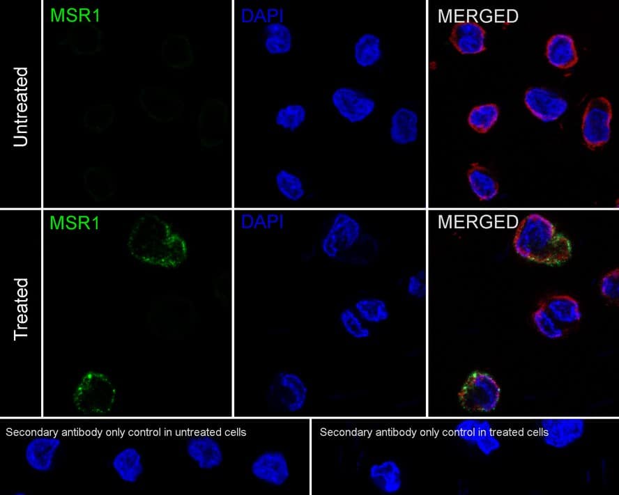 Immunocytochemistry/ Immunofluorescence: SR-AI/MSR Antibody (A8G2-R) [NBP3-32134] - Immunocytochemistry analysis of THP-1 cells treated with or without 50ng/mL PMA for 72 hours labeling SR-AI/MSR with Mouse anti-SR-AI/MSR antibody (NBP3-32134) at 1/100 dilution. Cells were fixed in 4% paraformaldehyde for 20 minutes at room temperature, permeabilized with 0.1% Triton X-100 in PBS for 5 minutes at room temperature, then blocked with 1% BSA in 10% negative goat serum for 1 hour at room temperature. Cells were then incubated with Mouse anti-SR-AI/MSR antibody (NBP3-32134) at 1/100 dilution in 1% BSA in PBST overnight at 4 ℃. Goat Anti-Mouse IgG H&L (iFluor™ 488) was used as the secondary antibody at 1/1,000 dilution. PBS instead of the primary antibody was used as the secondary antibody only control. Nuclear DNA was labelled in blue with DAPI. beta Tubulin (red) was stained at 1/100 dilution overnight at +4℃. Goat Anti-Rabbit IgG H&L (iFluor™ 594) were used as the secondary antibody at 1/1,000 dilution.