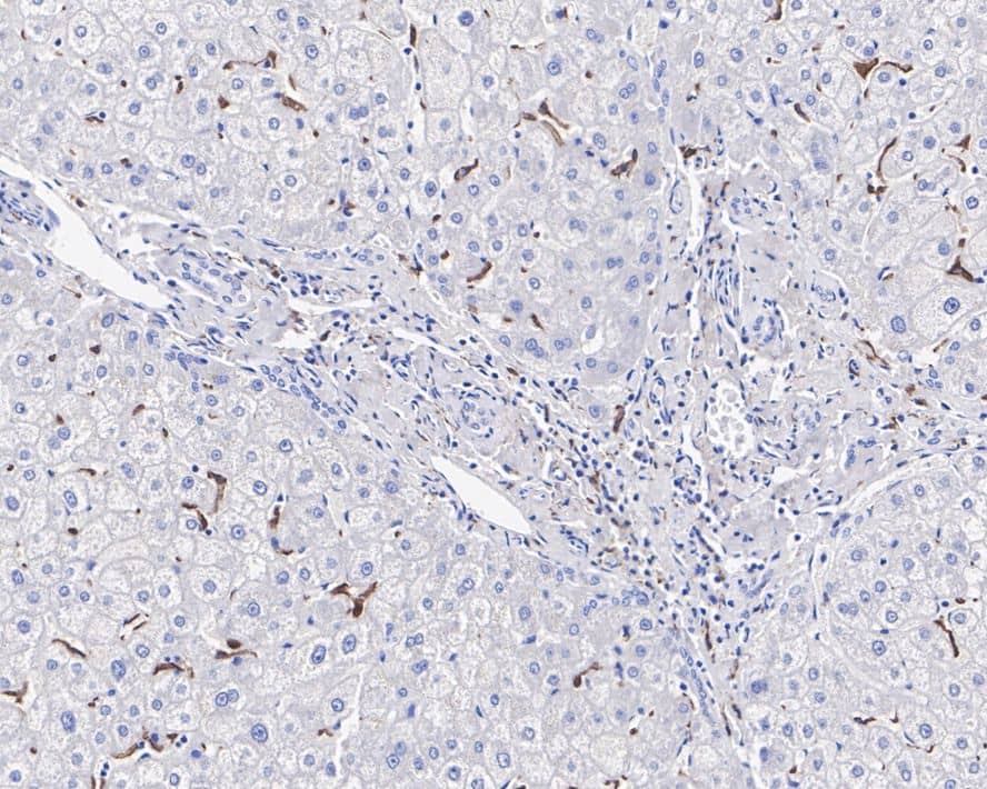 Immunohistochemistry: SR-AI/MSR Antibody (A8G2-R) [NBP3-32134] - Immunohistochemical analysis of paraffin-embedded human liver tissue with Mouse anti-SR-AI/MSR antibody (NBP3-32134) at 1μg/mL dilution. The section was pre-treated using heat mediated antigen retrieval with Tris-EDTA buffer (pH 9.0) for 20 minutes. The tissues were blocked in 1% BSA for 20 minutes at room temperature, washed with ddH2O and PBS, and then probed with the primary antibody (NBP3-32134) at 1μg/mL dilution for 1 hour at room temperature. The detection was performed using an HRP conjugated compact polymer system. DAB was used as the chromogen. Tissues were counterstained with hematoxylin and mounted with DPX.